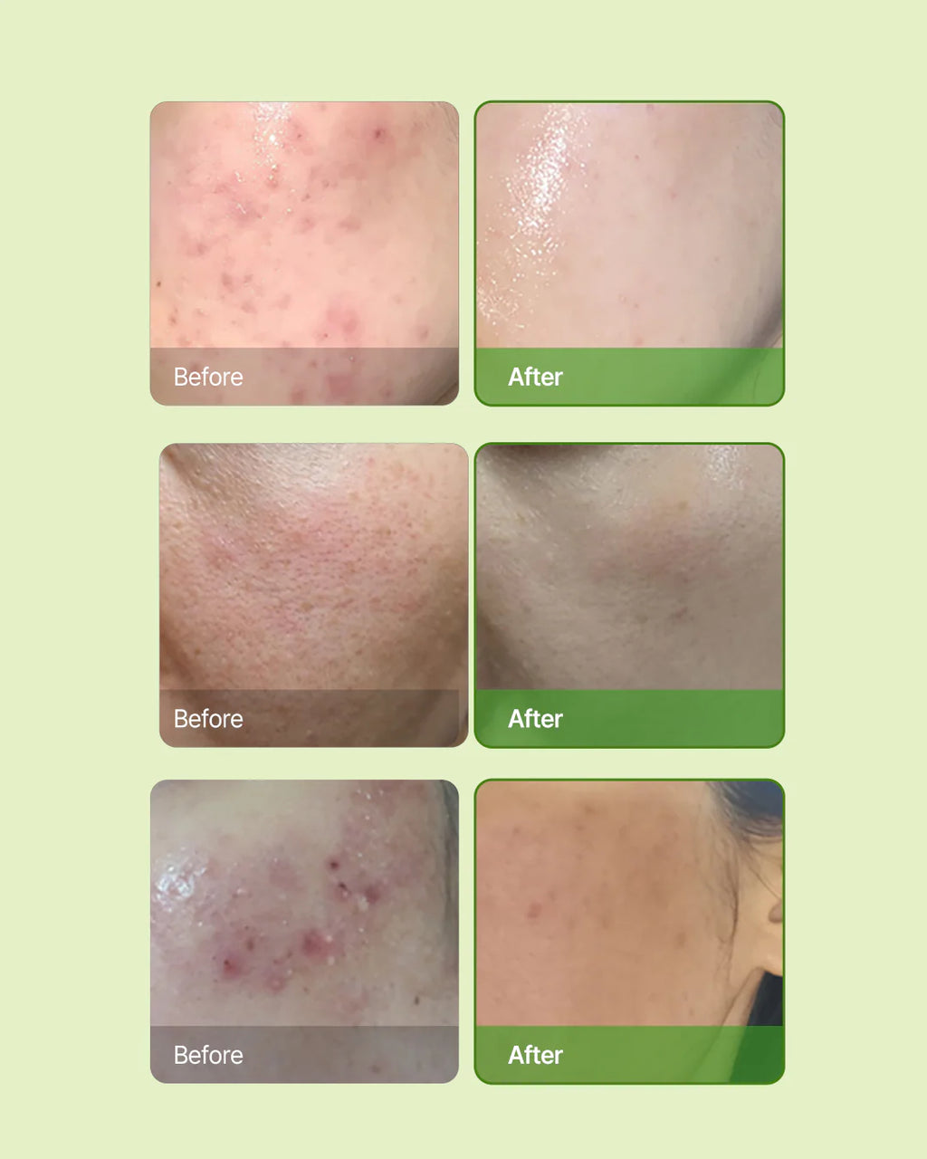 Skin Barrier Ato Cream